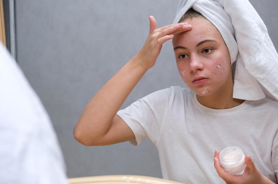 skincare routine, pimples